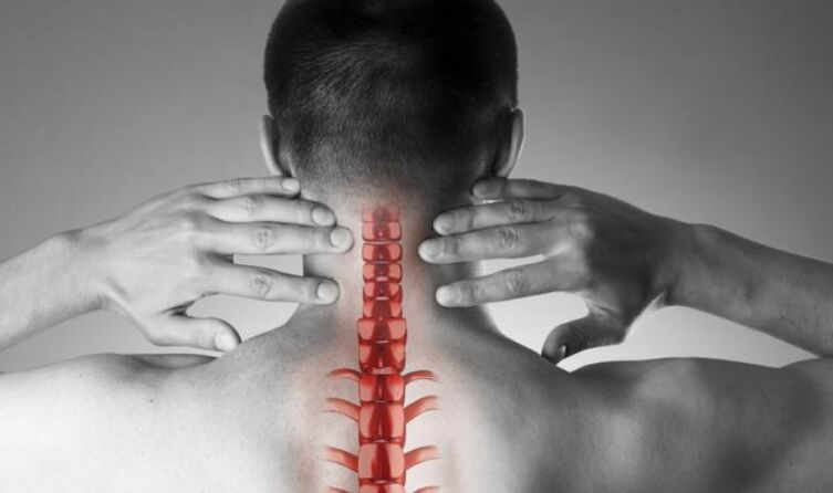Douleur prononcée dans le syndrome neurologique.