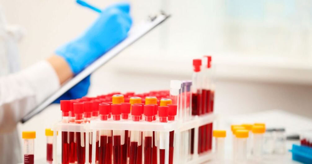 Effectuez une prise de sang pour détecter une inflammation.