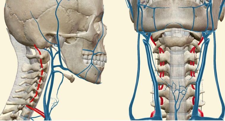 Syndrome vasculaire dans l'ostéochondrose.
